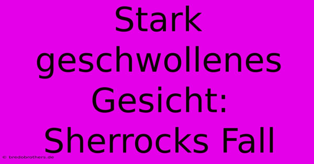 Stark Geschwollenes Gesicht: Sherrocks Fall